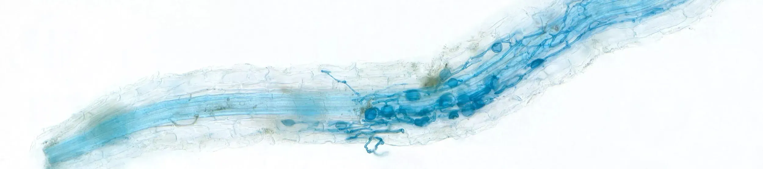 A blue image of a root full of mycorrhiza