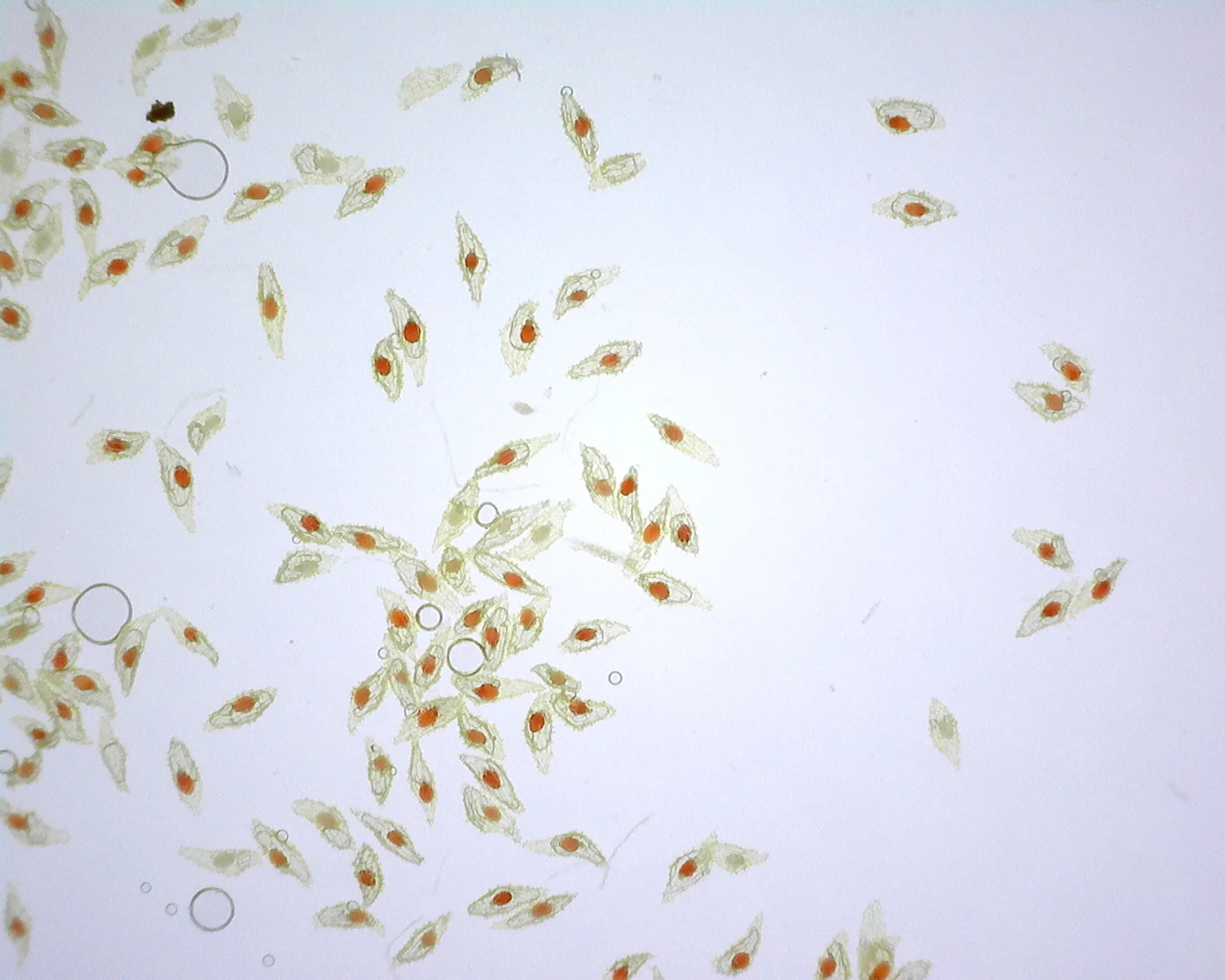 Approximately 100 orchid seeds, most of their embryos stained red by Tetrazolium Chloride. Some embryos are left transparent or grey in colour.